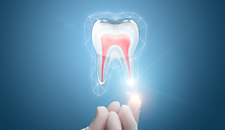 Dent Infectée : traitement de canal ou extraction dentaire ?